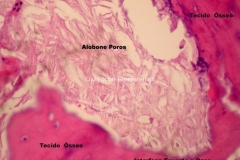 Histologia Alobone Foto 13