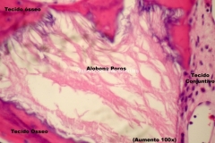 Histologia Alobone Foto 10