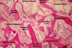 Histologia Alobone Foto 12