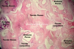 Histologia Alobone Foto 9