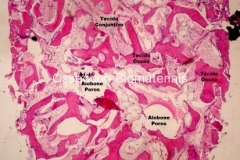 Histologia Alobone Foto 8