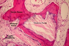 Histologia Alobone Foto 7