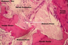 Histologia Alobone Foto 6