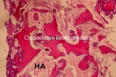 Histologia Alobone Foto 5