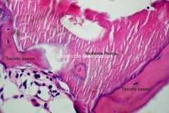 Histologia Alobone Foto 4
