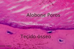 Histologia Alobone Foto 3