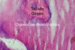 Histologia Alobone Foto 2