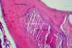 Histologia Alobone Foto 1