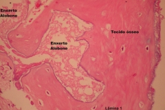 Histologia Alobone Foto 14