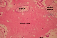 Histologia Alobone Foto 15