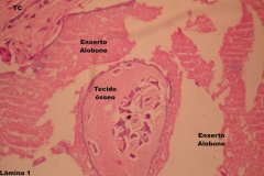 Histologia Alobone Foto 16