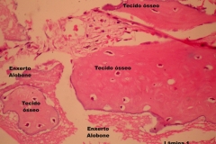 Histologia Alobone Foto 17