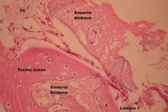 Histologia Alobone Foto 18