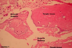 Histologia Alobone Foto 19