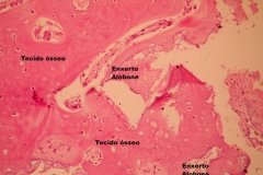 Histologia Alobone Foto 20