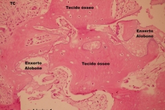 Histologia Alobone Foto 21