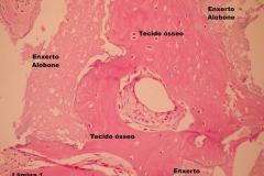 Histologia Alobone Foto 22