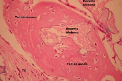 Histologia Alobone Foto 23