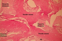 Histologia Alobone Foto 24