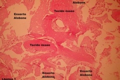 Histologia Alobone Foto 25