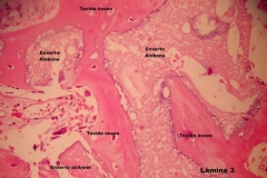 Histologia Alobone Foto 26
