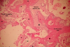Histologia Alobone Foto 27