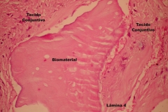 Histologia Alobone Foto 28