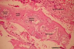 Histologia Alobone Foto 29