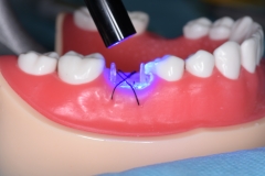 Placa de Proteção Alveolar com Haste / PPAH 6