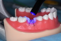 Placa de Proteção Alveolar com Haste / PPAH 5